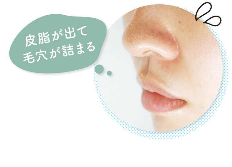 皮脂が出て毛穴が詰まる