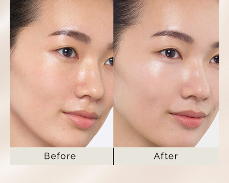 Before After