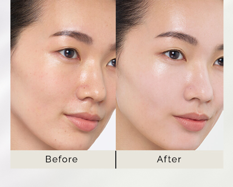 Before After