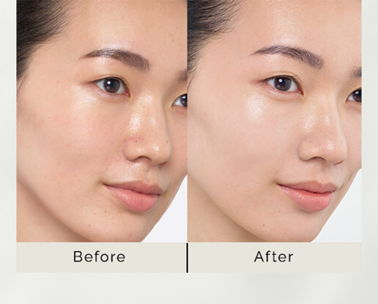 Before After