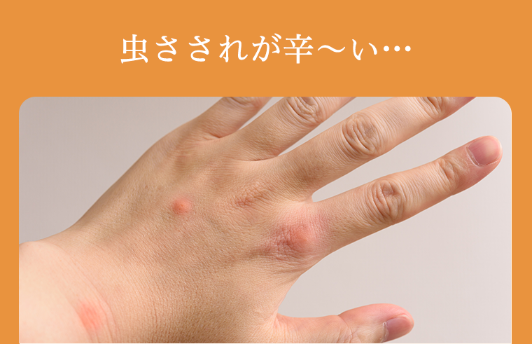 虫さされが辛～い・・・