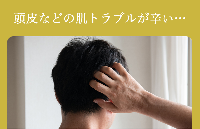 頭皮などの肌トラブルが辛い・・・
