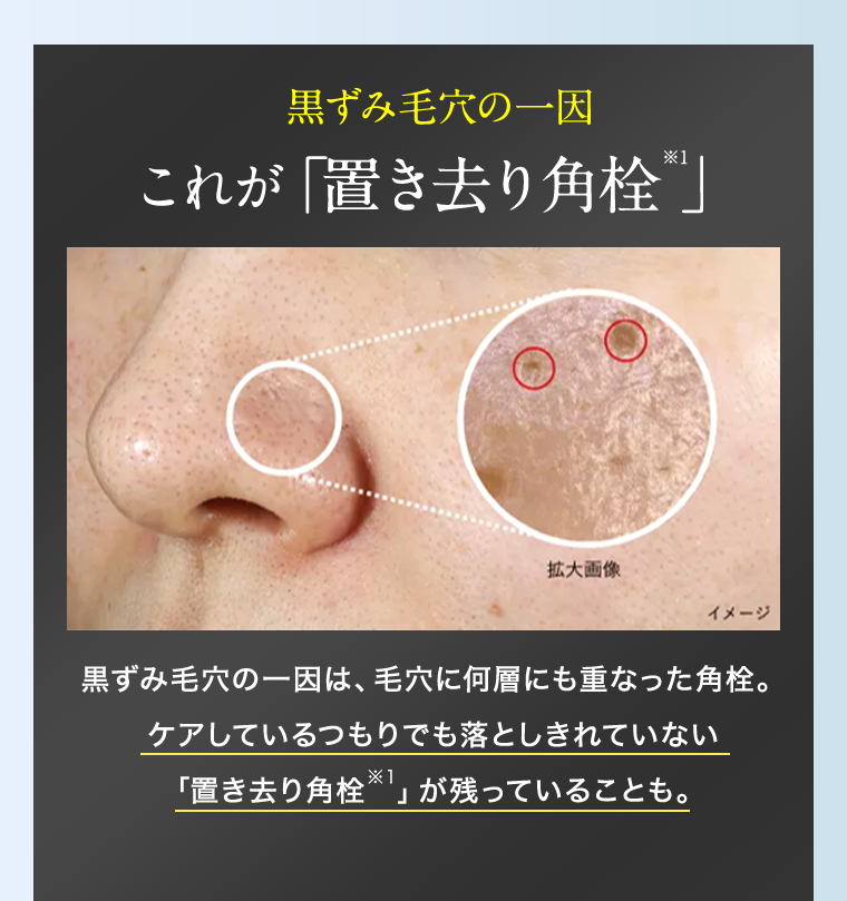 これが「置き去り角栓」
