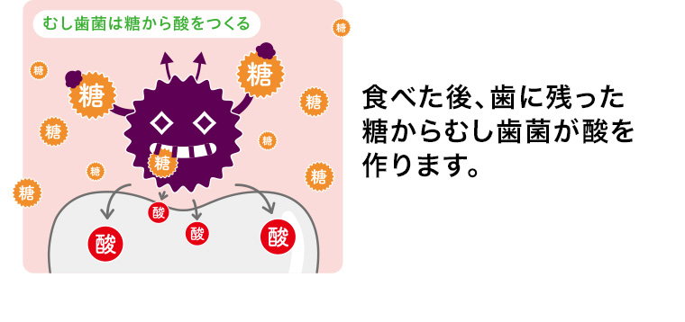食べた後、歯に残った糖からむし歯菌が酸を作ります。
