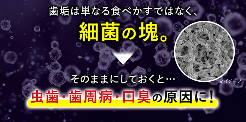 歯垢は単なる食べかすではなく、細菌の塊。そのままにしておくと…虫歯・歯周病・口臭の原因に!