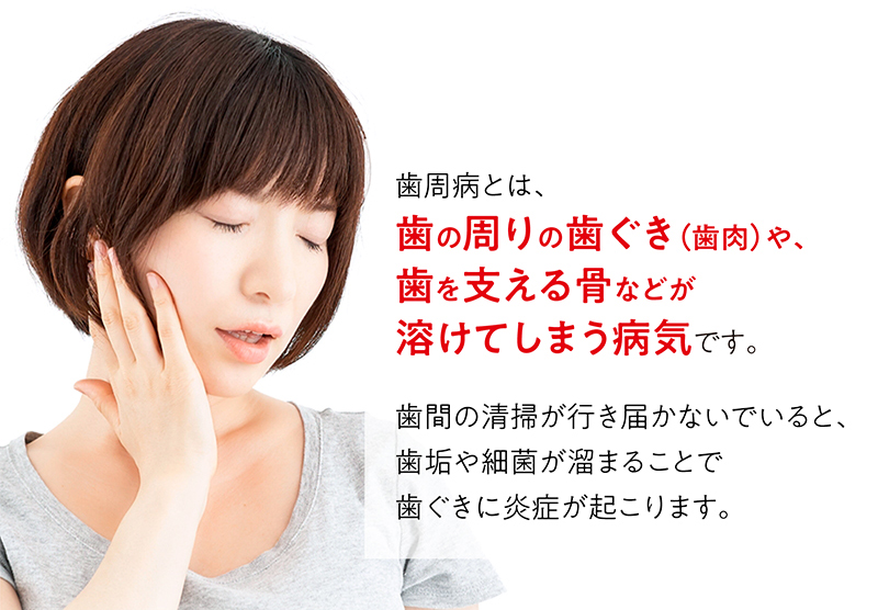 歯周病とは、歯の周りの歯ぐき（歯肉）や、歯を支える骨などが溶けてしまう病気です。
