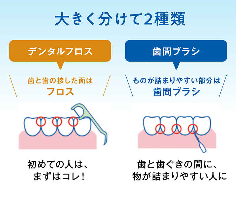 大きく分けて2種類「デンタルフロス」「歯間ブラシ」