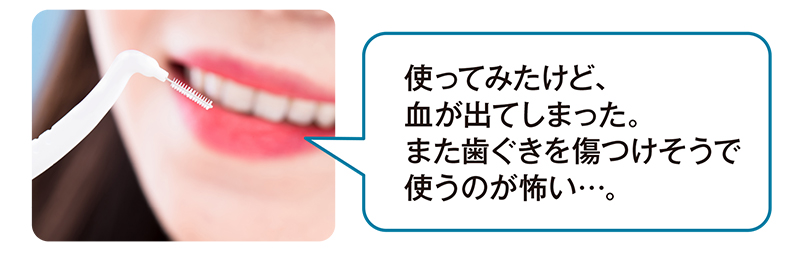使ってみたけど、血が出てしまった。また歯ぐきを傷つけそうで使うのが怖い…。※個人の感想です
