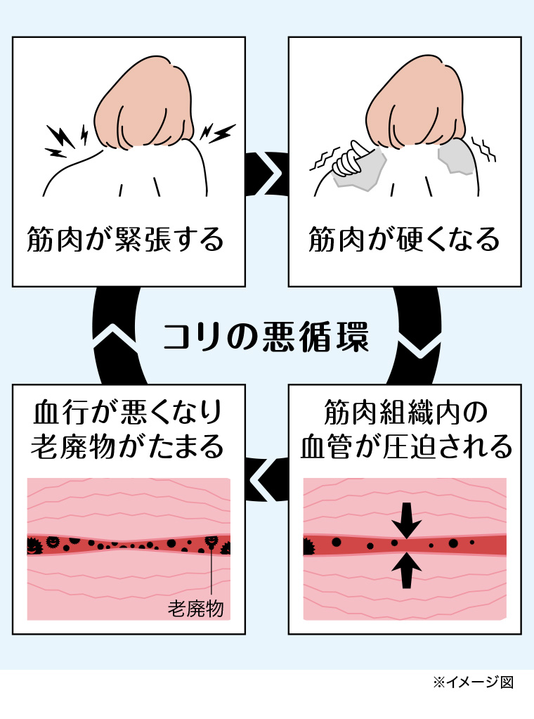 コリの悪循環 筋肉が緊張する 筋肉が硬くなる 血行が悪くなり老廃物がたまる 筋肉組織内の血管が圧迫される
