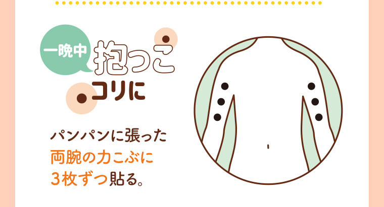 一晩中抱っこコリに パンパンに張った両腕の力こぶに3枚ずつ貼る。