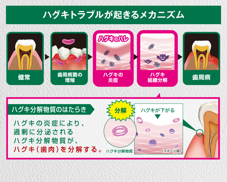 ハグキトラブルが起きるメカニズム
