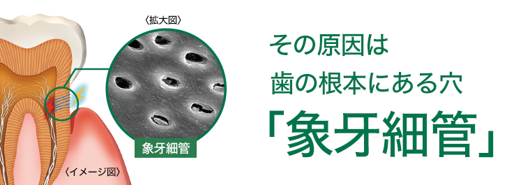 その原因は歯の根本にある穴「象牙細管」