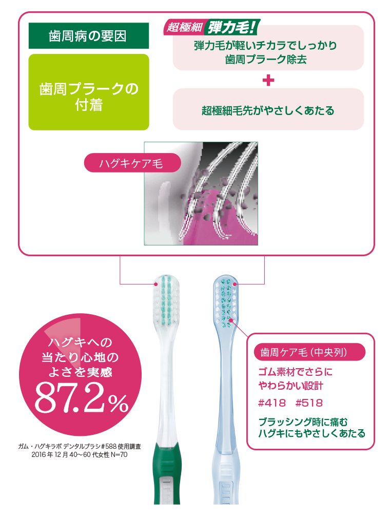 歯周病の要因　歯周プラークの付着