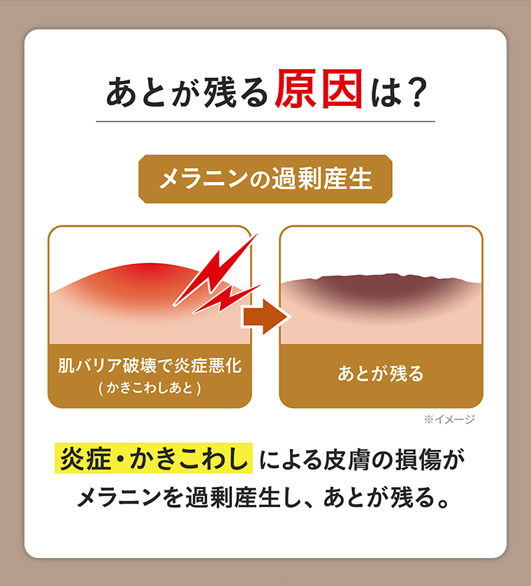 あとが残る原因は？