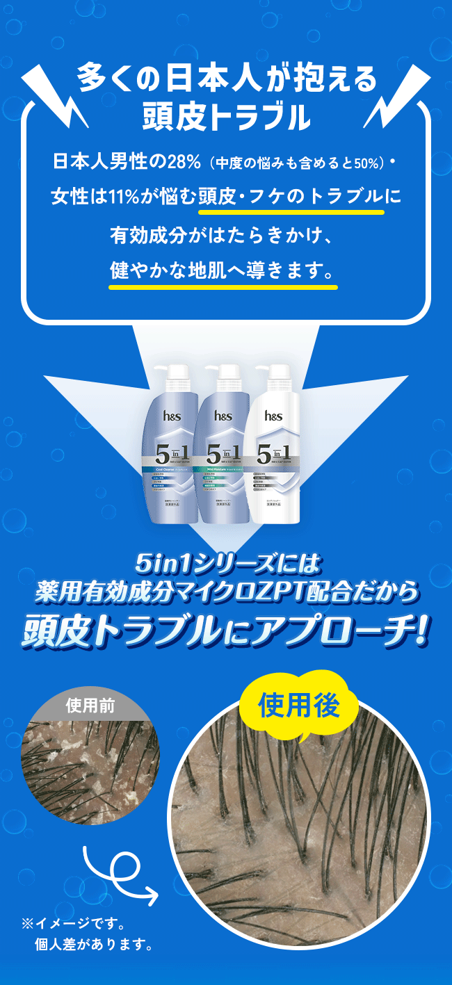 多くの日本人が抱える頭皮トラブル|日本人男性の28%（中度の悩みも含めると50%）・女性は11%が悩む頭皮・フケのトラブルに有効成分がはたらきかけ、健やかな地肌へ導きます。|5in1シリーズには薬用有効成分マイクロZPT配合だから頭皮トラブルにアプロ―チ！