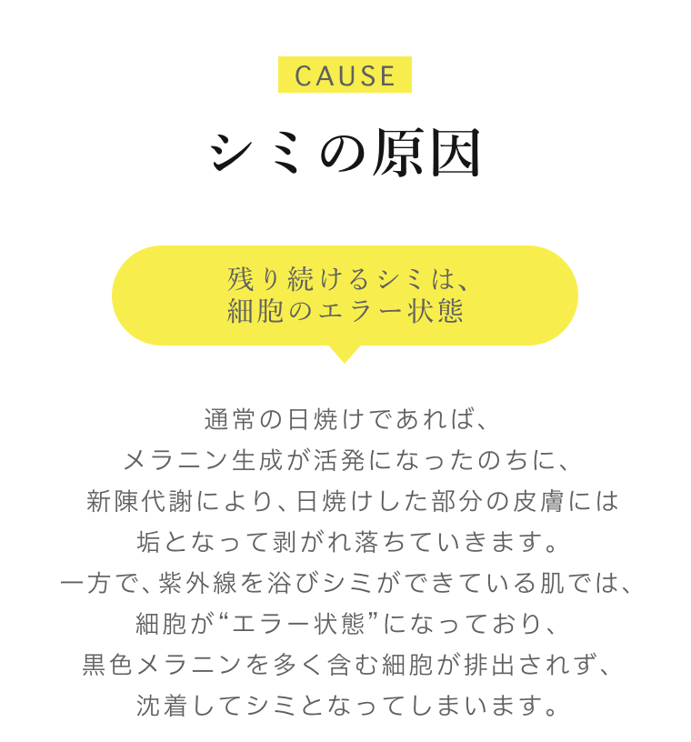 シミの原因
