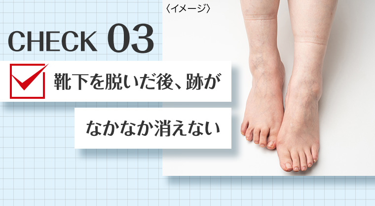 CHECK 03 靴下を脱いだ後、跡がなかなか消えない
