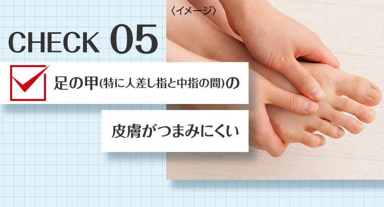 CHECK 05 足の甲 (特に人差し指と中指の間)の皮膚がつまみにくい