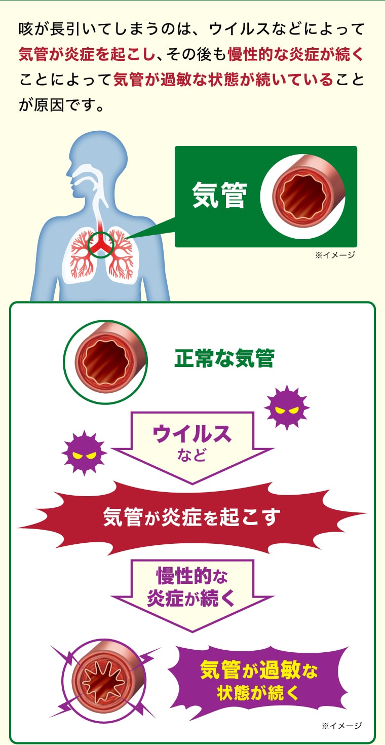 咳が長引いてしまうのは、ウイルスなどによって気管が炎症を起こし、その後も慢性的な炎症が続くことによって気管が過敏な状態が続いていることが原因です。