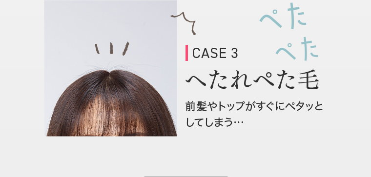 CASE 3へたれぺた毛　前髪やトップがすぐにペタッと してしまう...