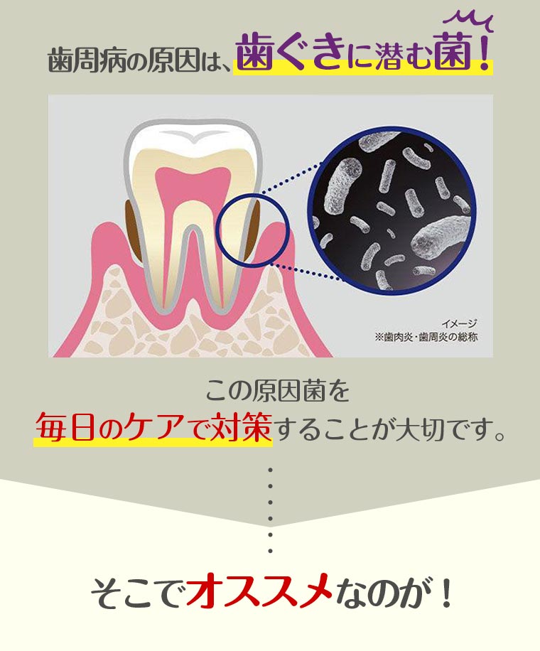 歯周病の原因は、歯ぐきに潜む菌！そこでオススメなのが！　