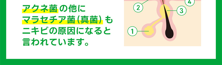 アクネ菌の他にマラセチア菌 (真菌) もニキビの原因になると言われています。