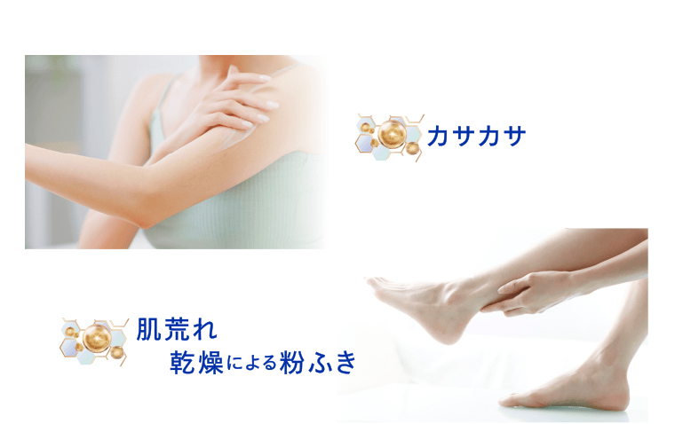 カサカサ　肌荒れ　乾燥による粉ふき