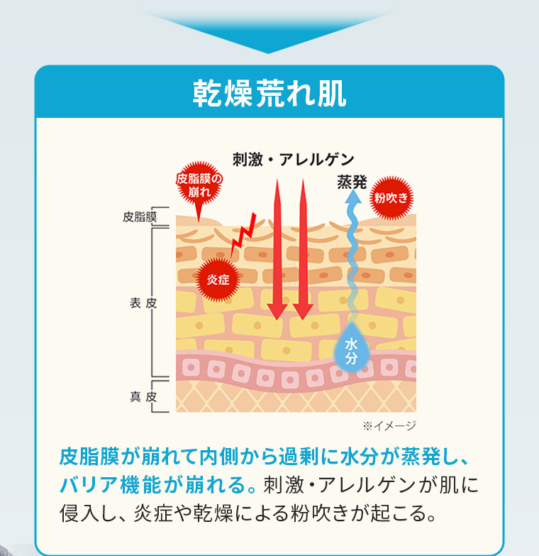 【乾燥荒れ肌】皮脂膜が崩れて内側から過剰に水分が蒸発し、バリア機能が崩れる。刺激・アレルゲンが肌に侵入し、炎症や乾燥による粉吹きが起こる。