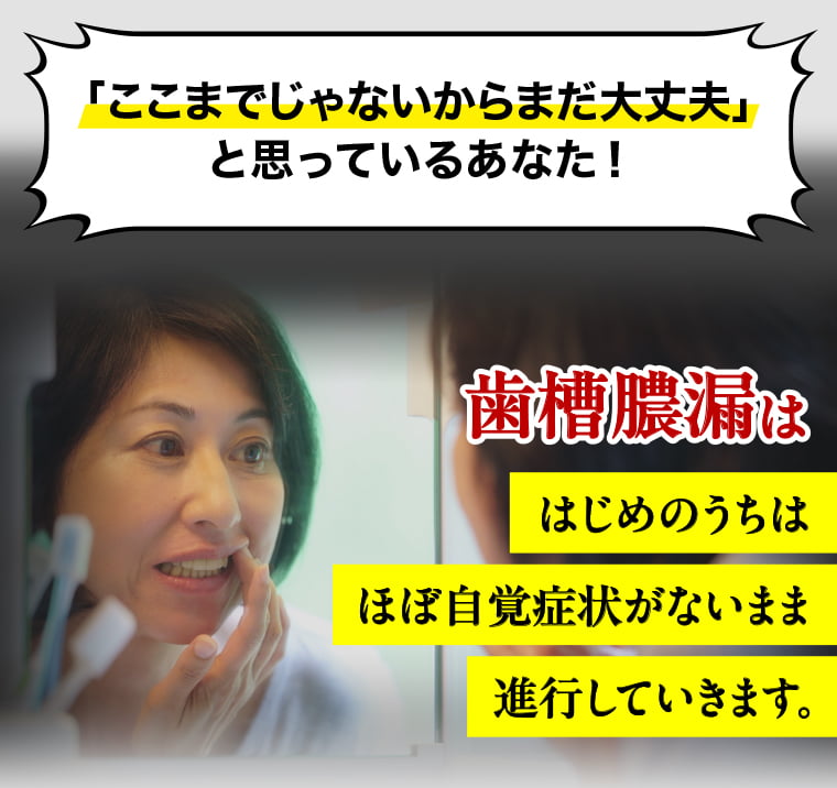 「ここまでじゃないからまだ大丈夫」と思っているあなた！歯槽膿漏ははじめのうちはほぼ自覚症状がないまま進行していきます。