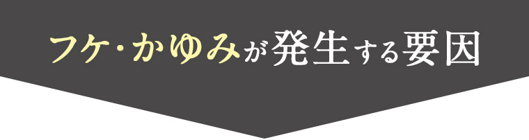 フケ・かゆみが発生する要因