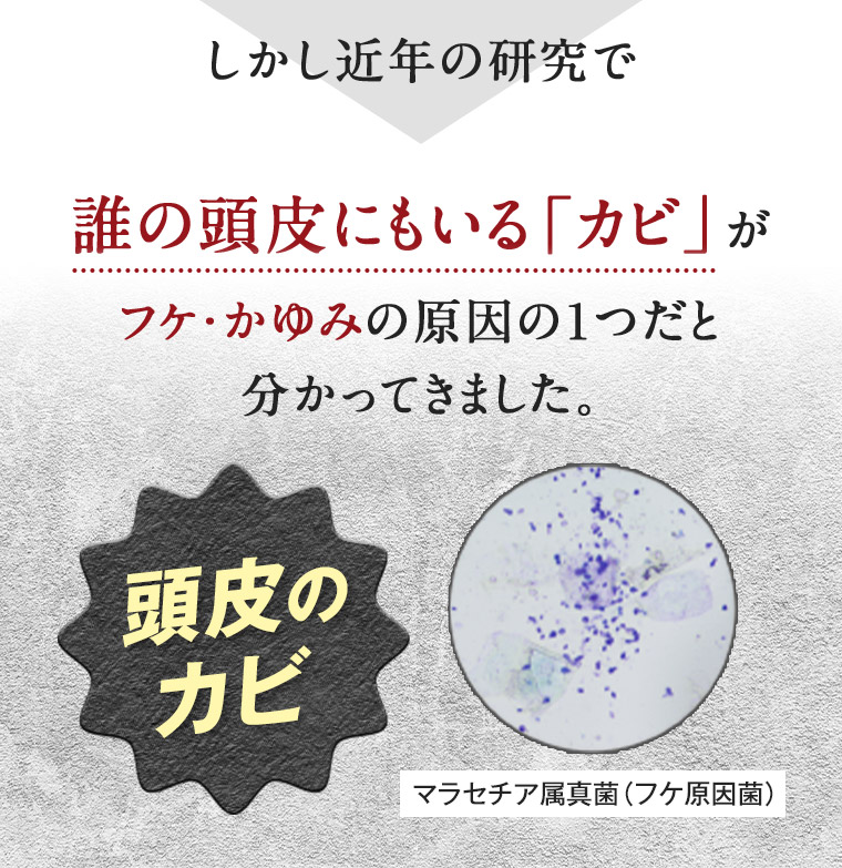 しかし近年の研究で誰の頭皮にもいる「カビ」がフケ・かゆみの原因の1つだと分かってきました。