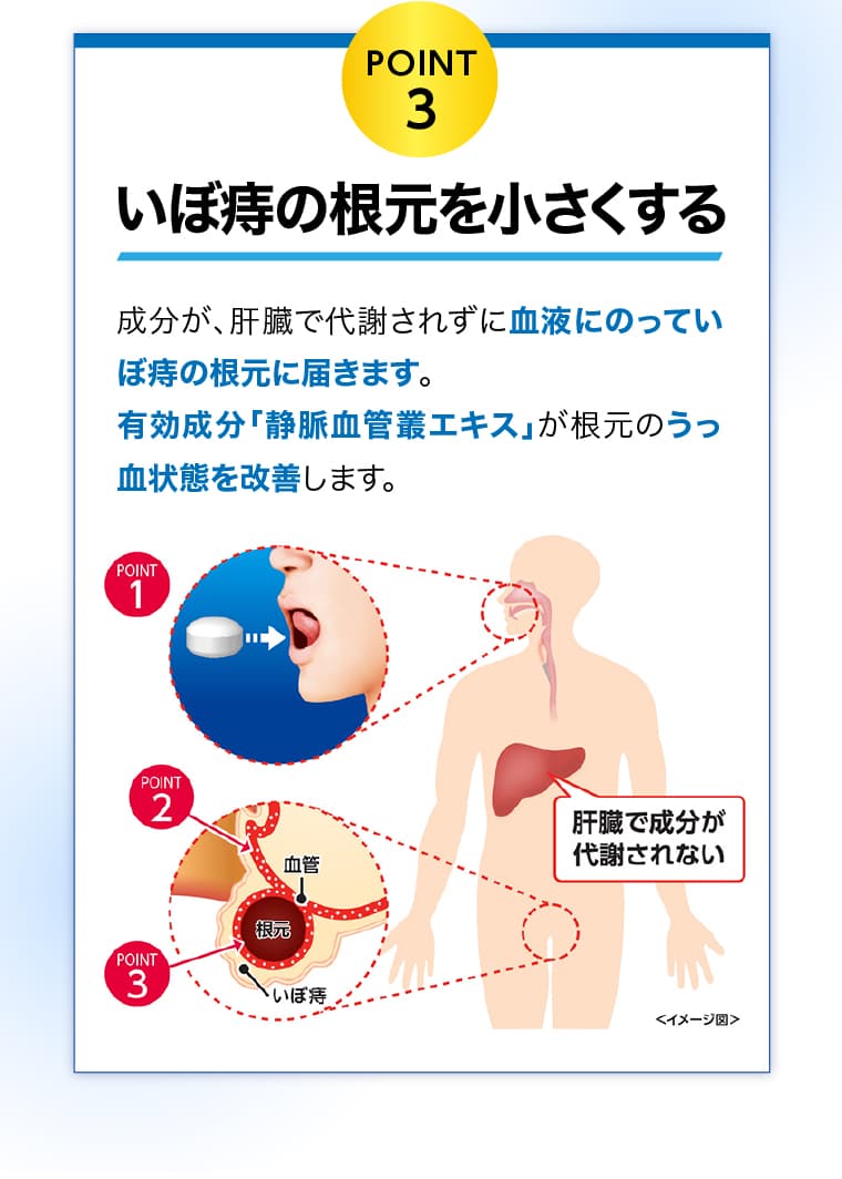 POINT3 - いぼ痔の根元を小さくする