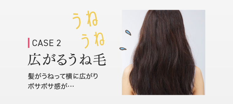 CASE2　広がるうね毛