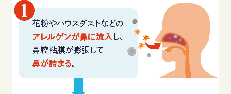 ①花粉やハウスダストなどのアレルゲンが鼻に流入し、鼻腔粘膜が膨張して鼻が詰まる。