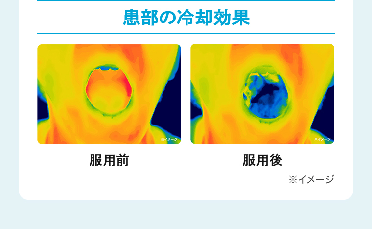 患部の冷却効果※イメージ