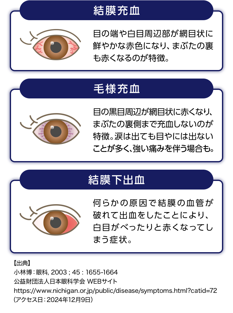 結末充血 毛様充血 結末下出血
