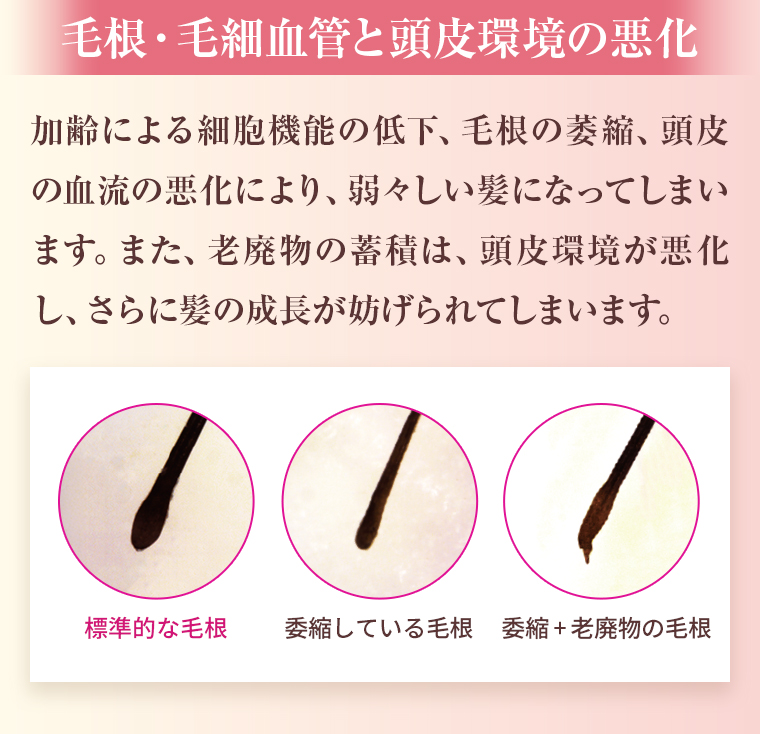 毛根・毛細血管と頭皮環境の悪化：加齢による細胞機能の低下、毛根の萎縮、頭皮の血流の悪化により、弱々しい髪になってしまいます。また、老廃物の蓄積は、頭皮環境が悪化し、さらに髪の成長が妨げられてしまいます。