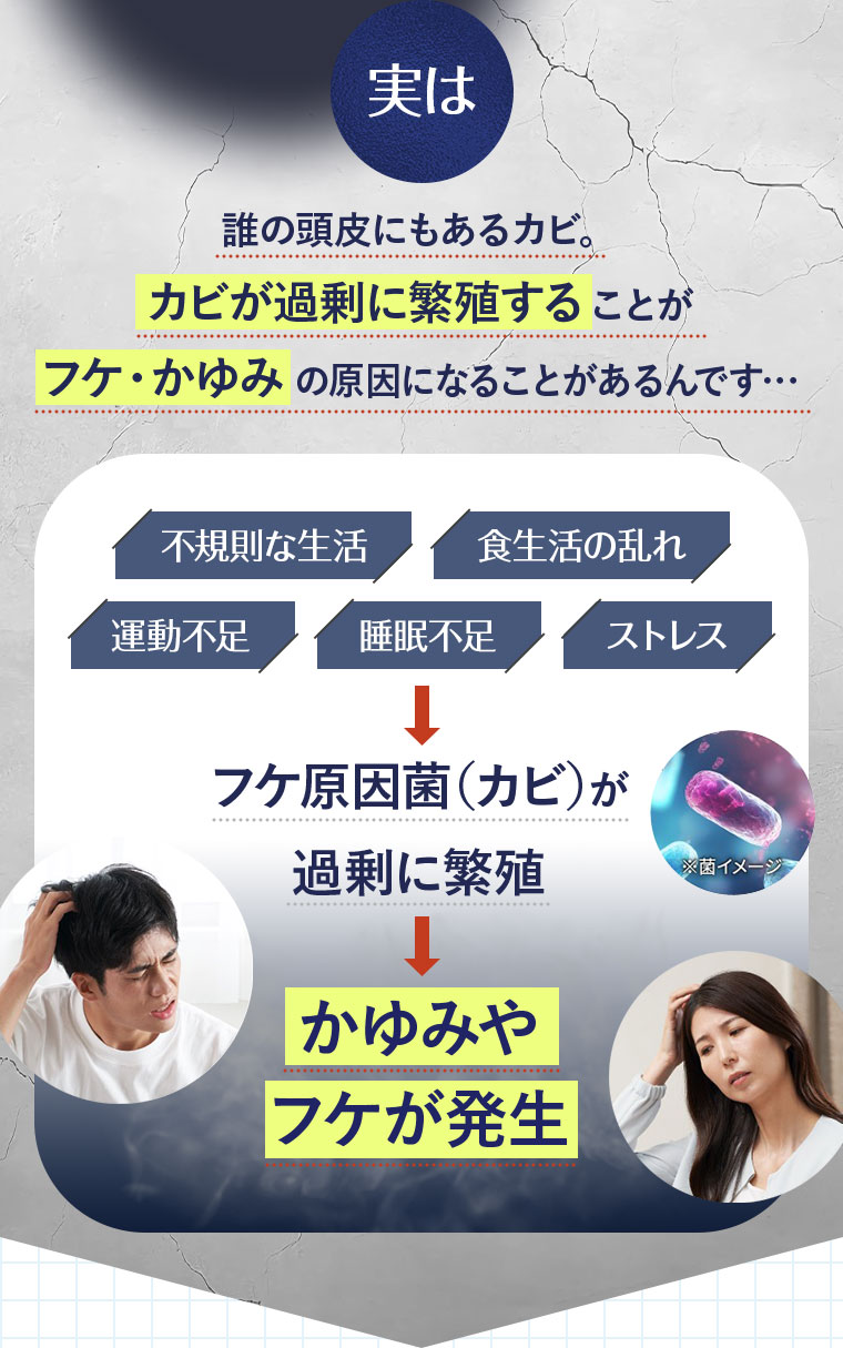 実は 誰の頭皮にもあるカビ カビが過剰に繁殖することがフケ・かゆみの原因になることがあるんです 不規則な生活 食生活の乱れ 運動不足 睡眠不足 ストレス フケ原因菌（カビ）が過剰に繁殖 かゆみやフケが発生