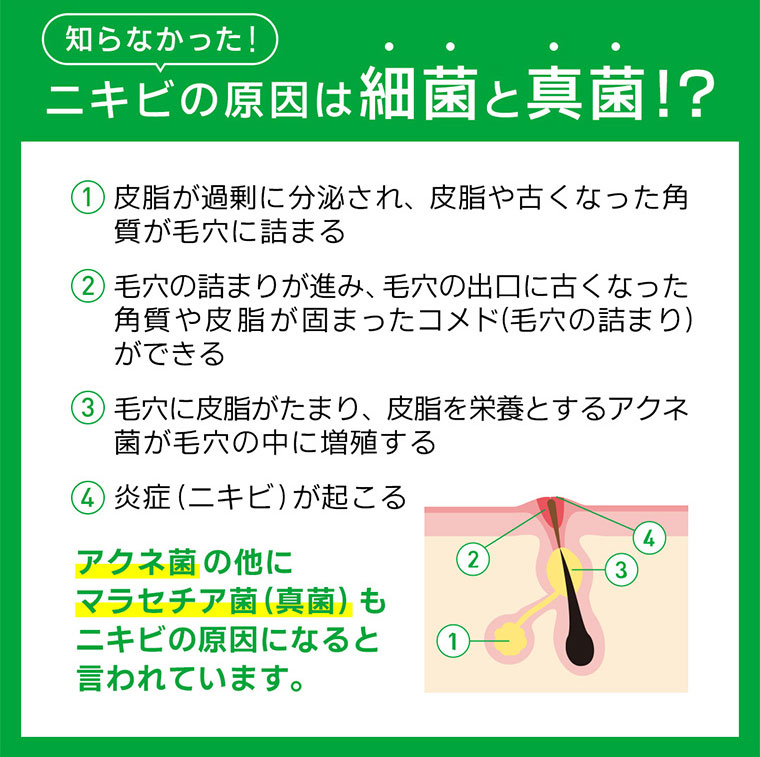 知らなかった！ニキビの原因は細菌と真菌！？