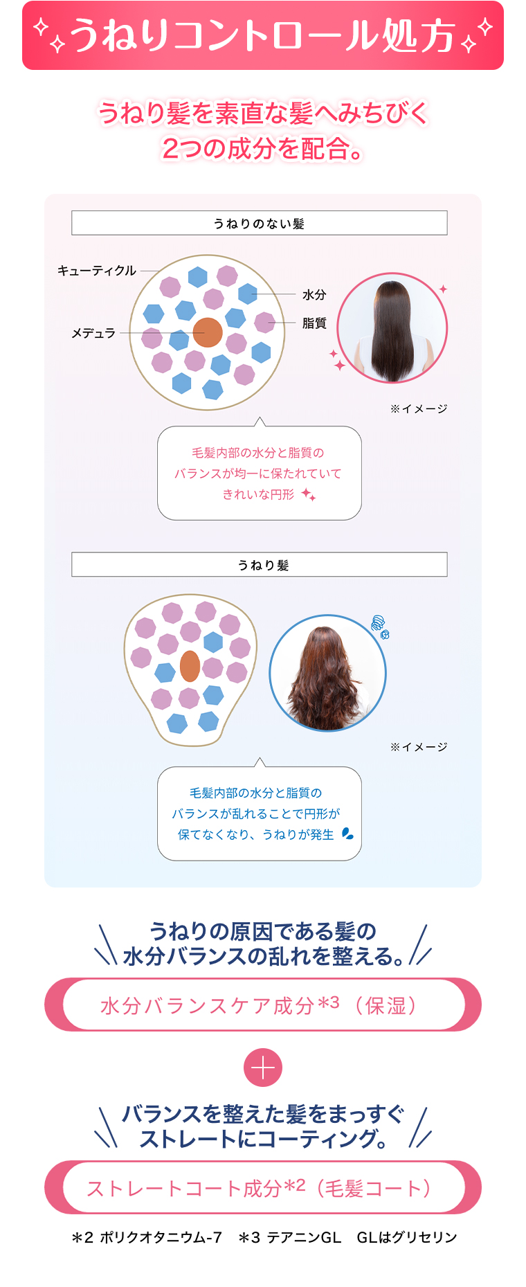 うねりコントロール処方