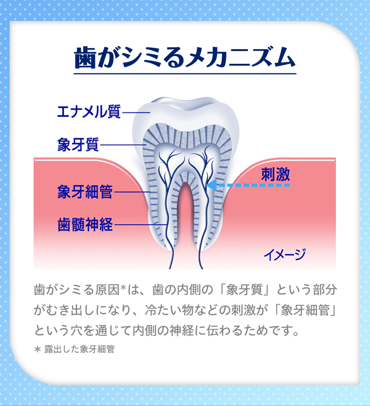 歯がシミるメカニズム