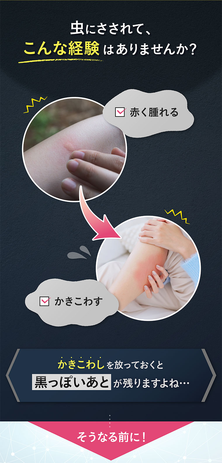 虫にさされて、こんな経験はありませんか？