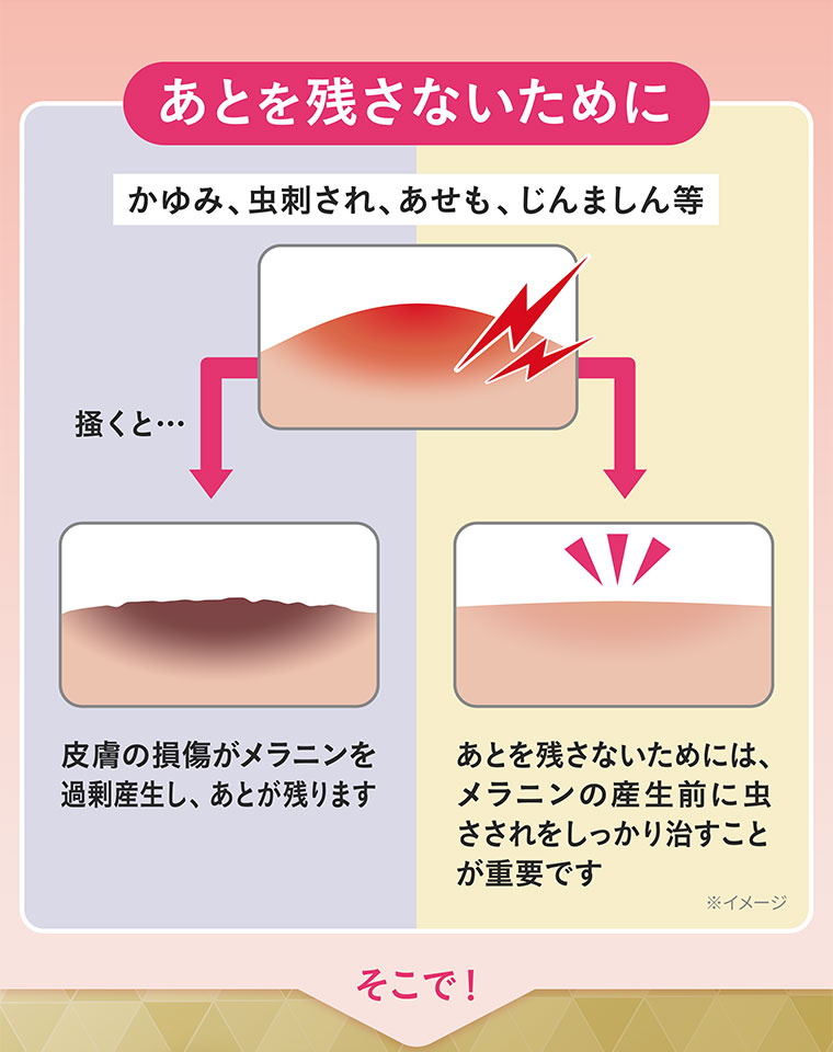 あとを残さないために