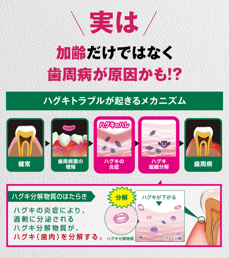 加齢だけではなく歯周病が原因かも