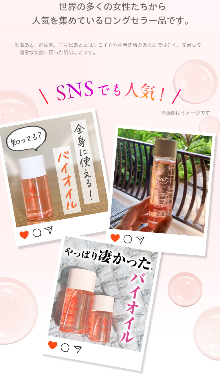 世界の多くの女性たちから人気を集めているロングセラー品です SNSでも人気！ 知ってる？ 全身に使える！バイオイル やっぱり凄かった。バイオイル