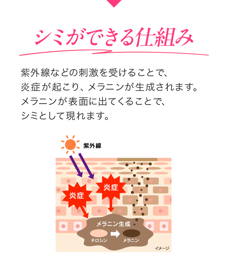 シミができる仕組み