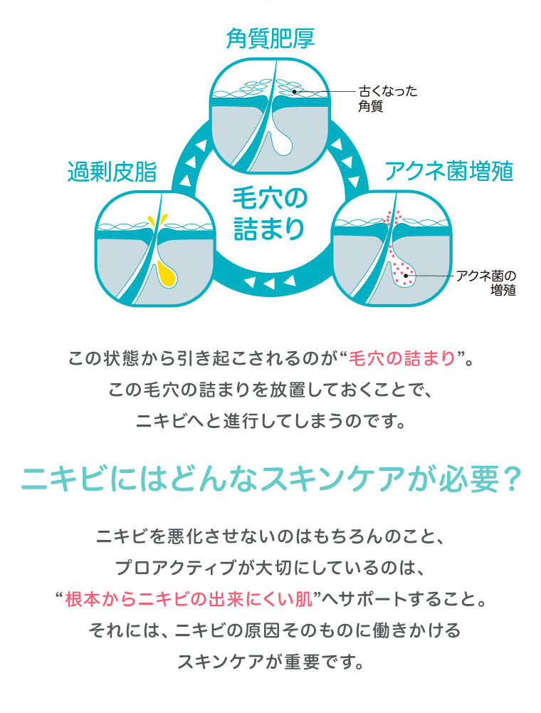 毛穴の詰まりを放置しておくことで、ニキビへと進行　ニキビにはどんなスキンケアが必要