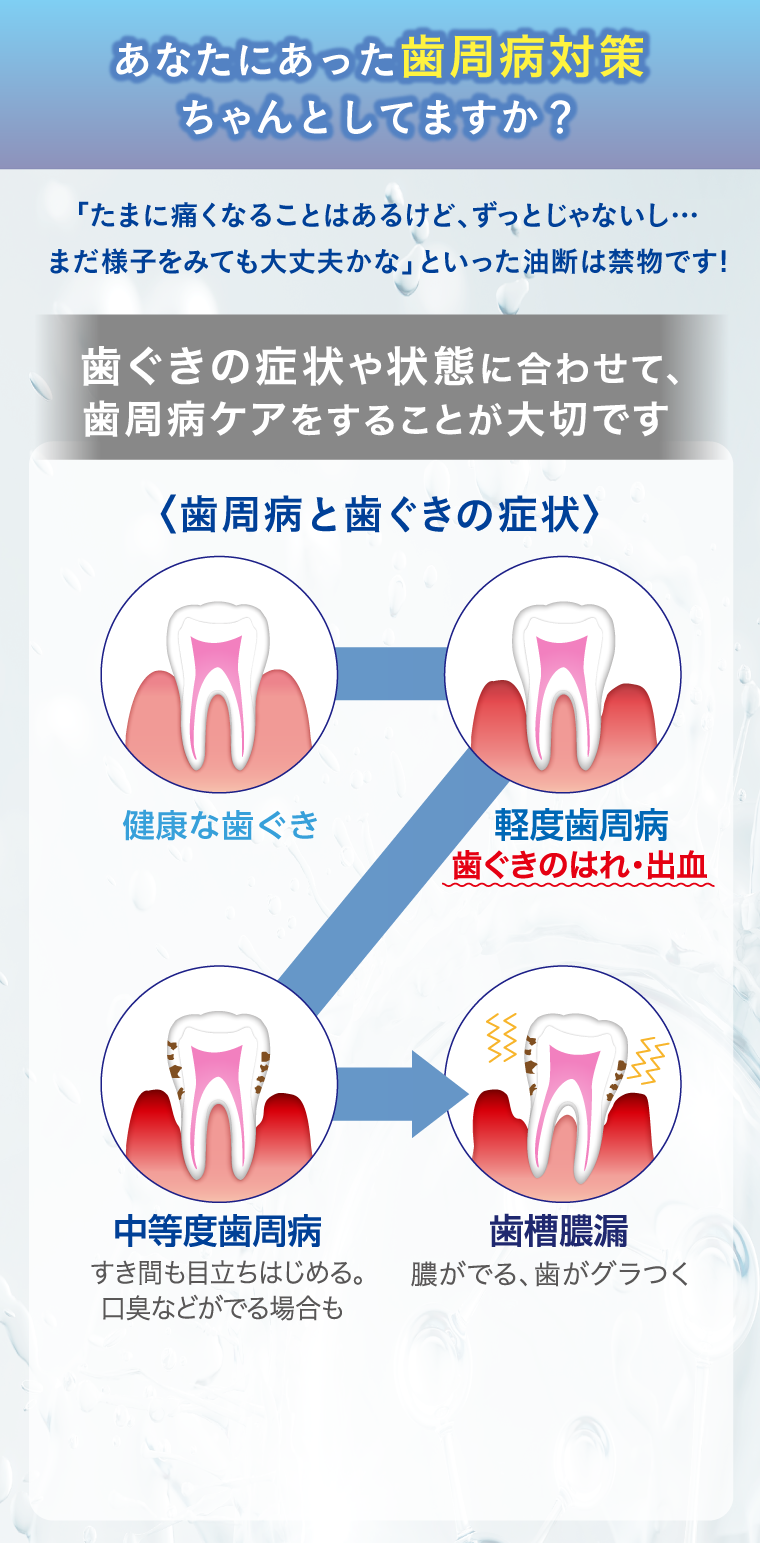 あなたにあった歯周病対策ちゃんとしてますか？