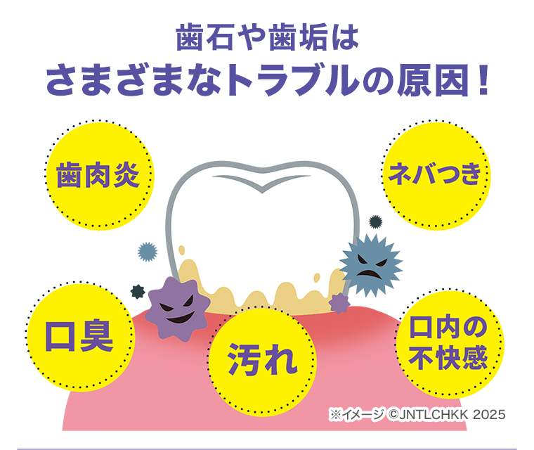 歯石や歯垢はトラブルの原因