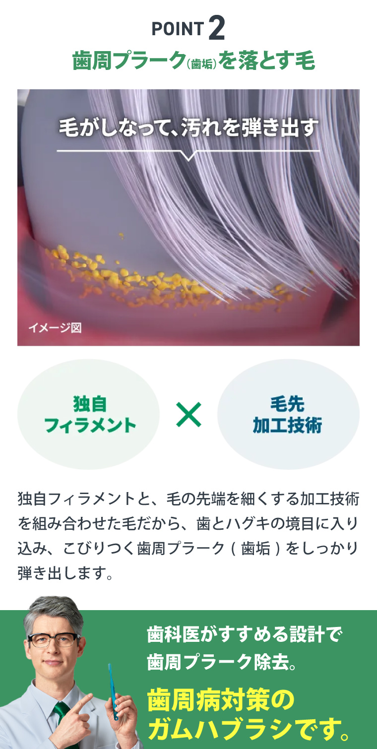 POINT2　歯周プラーク（歯垢）を落とす毛